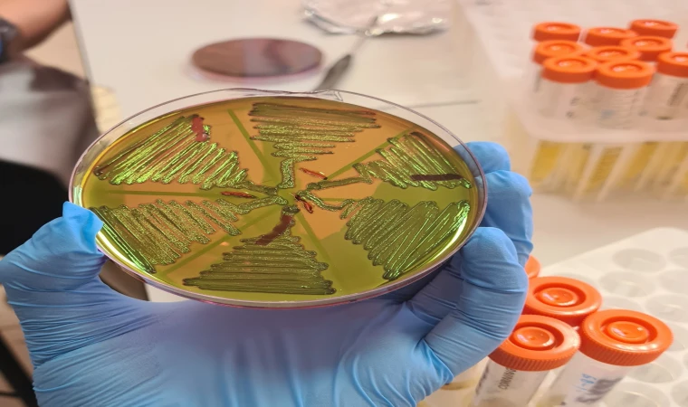 "Çiğ Süt Tüketimi, İdrar Yolu Enfeksiyonları Riskini Artırıyor"