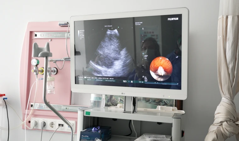 Akciğer Kanseri Tanısında Modern Yöntem: EBUS ile Ameliyatsız Tanı Dönemi