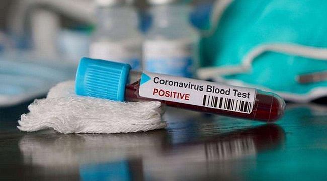 Coronavirus vakalarında rekor artış 