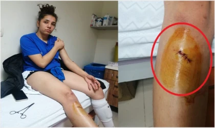 Malatya'nın kadın sporcularına saldırıp, hastanelik ettiler!..