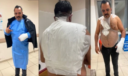 Meşhur tostçu, soğuk havada şov yapmak isterken kendini yaktı