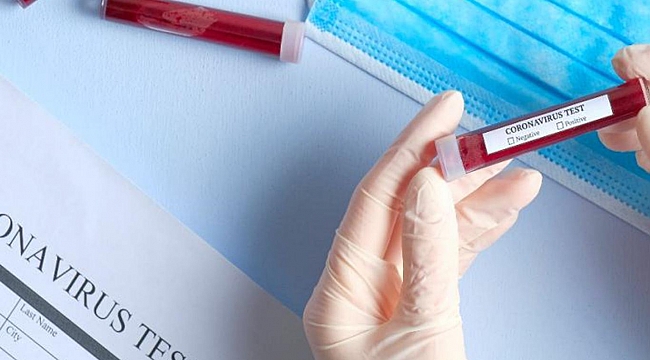 Türkiye'de Coronavirus nedeniyle can kaybı 98 artarak 1296'ya yükseldi