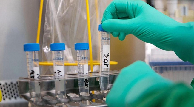 Türkiye'de Coronavirus kaynaklı ölümlerde düşüş sürüyor