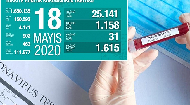 Türkiye'de Covid-19'dan 31 kişi daha hayatını kaybetti, bin 158 yeni tanı kondu