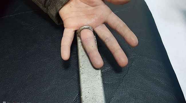 Parmağı demir yüzüğe sıkışan çocuk itfaiye ekipleri tarafından kurtarıldı